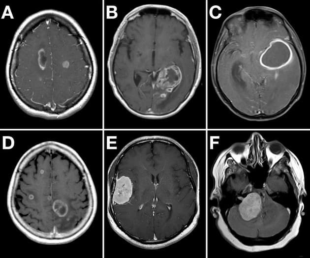 Brain X-ray